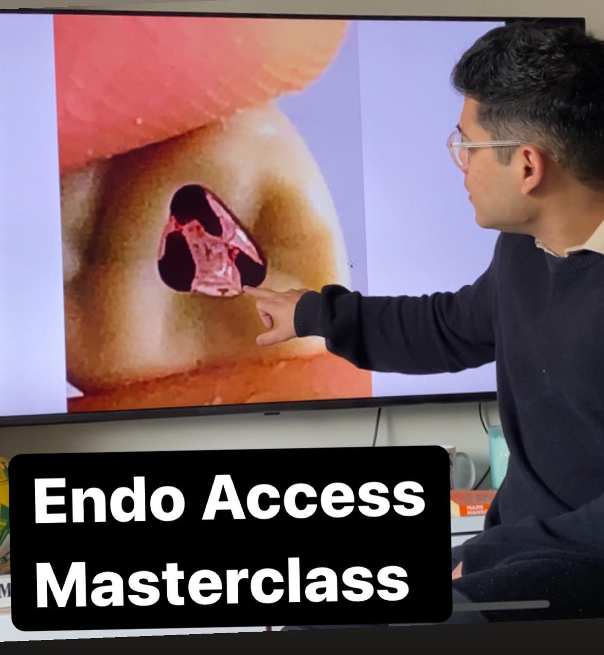 Endo Access Masterclass